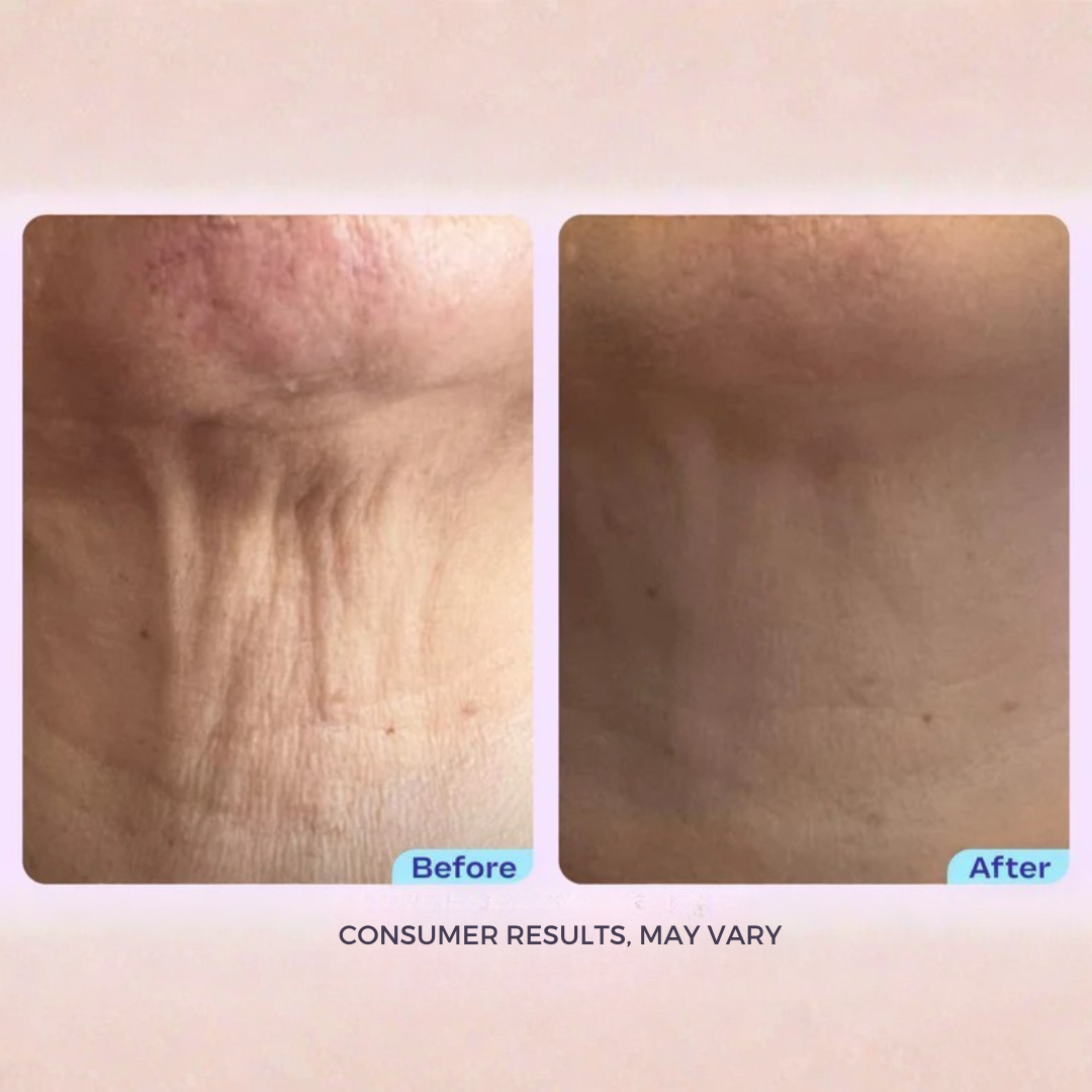 RHOÉ l Tighten & Lift Neck Cream