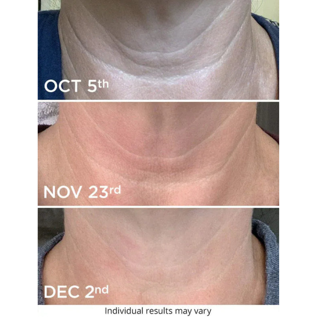 RHOÉ l Tighten & Lift Neck Cream